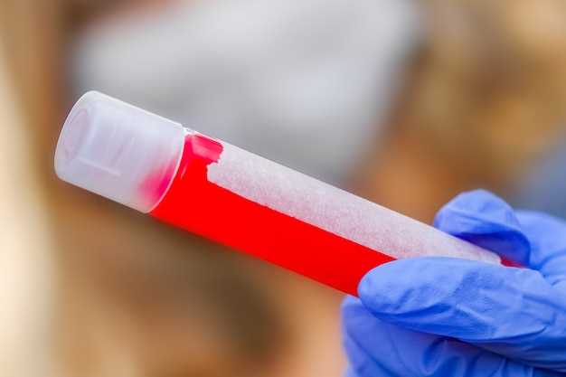 Как проводится анализ крови на литий
