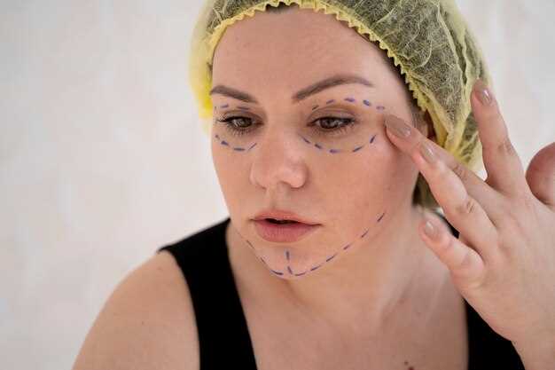 Методы лечения гематомы на лице