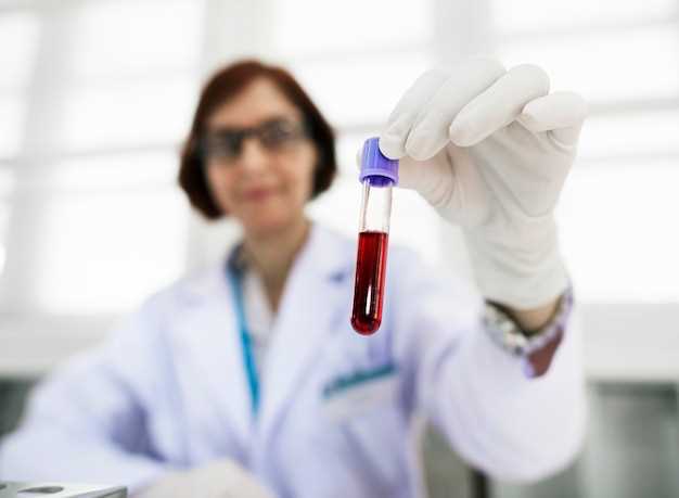 Как правильно сдать анализ крови на ТТГ