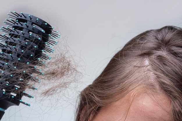 Как пробудить сильные и здоровые луковицы волос