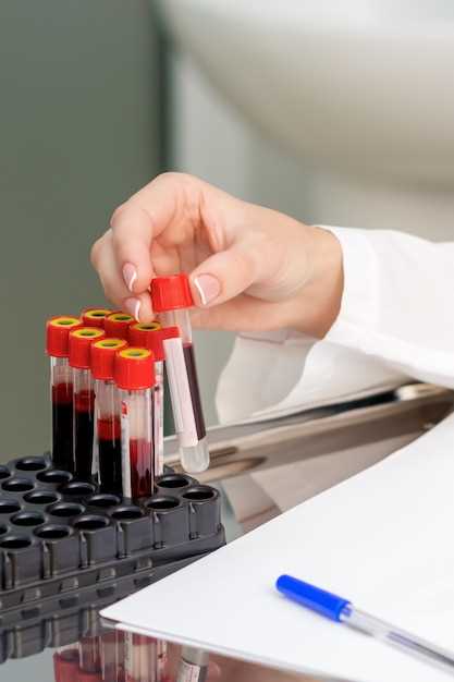 Как проходит исследование крови?